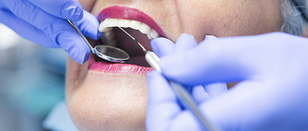 Best Emergency Dental Care for Broken or Chipped Teeth in Woodville, WI